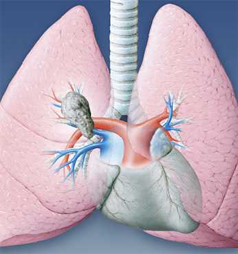 2. Natriumcarbonat als Kombinationstherapie