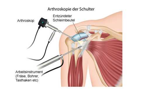 Aufwärmen und Dehnen vor dem Sport