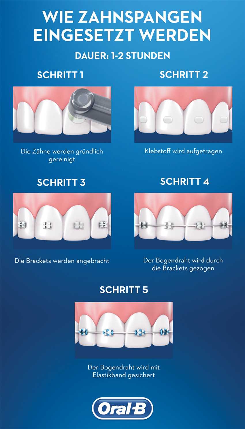 Pflege und Wartung einer Zahnspange